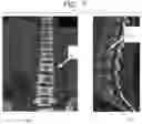 Fig. 11 - APPARATUS AND METHODS FOR USE WITH IMAGE-GUIDED SKELETAL PROCEDURES