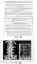 Fig. 12 - APPARATUS AND METHODS FOR USE WITH IMAGE-GUIDED SKELETAL PROCEDURES