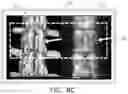 Fig. 13 - APPARATUS AND METHODS FOR USE WITH IMAGE-GUIDED SKELETAL PROCEDURES