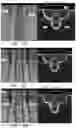 Fig. 24 - APPARATUS AND METHODS FOR USE WITH IMAGE-GUIDED SKELETAL PROCEDURES