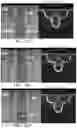 Fig. 25 - APPARATUS AND METHODS FOR USE WITH IMAGE-GUIDED SKELETAL PROCEDURES
