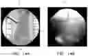 Fig. 27 - APPARATUS AND METHODS FOR USE WITH IMAGE-GUIDED SKELETAL PROCEDURES