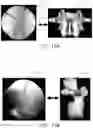 Fig. 28 - APPARATUS AND METHODS FOR USE WITH IMAGE-GUIDED SKELETAL PROCEDURES