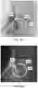 Fig. 32 - APPARATUS AND METHODS FOR USE WITH IMAGE-GUIDED SKELETAL PROCEDURES