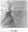 Fig. 33 - APPARATUS AND METHODS FOR USE WITH IMAGE-GUIDED SKELETAL PROCEDURES