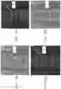 Fig. 37 - APPARATUS AND METHODS FOR USE WITH IMAGE-GUIDED SKELETAL PROCEDURES
