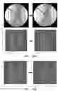 Fig. 38 - APPARATUS AND METHODS FOR USE WITH IMAGE-GUIDED SKELETAL PROCEDURES