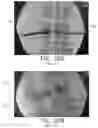 Fig. 41 - APPARATUS AND METHODS FOR USE WITH IMAGE-GUIDED SKELETAL PROCEDURES