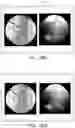 Fig. 44 - APPARATUS AND METHODS FOR USE WITH IMAGE-GUIDED SKELETAL PROCEDURES
