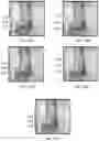 Fig. 47 - APPARATUS AND METHODS FOR USE WITH IMAGE-GUIDED SKELETAL PROCEDURES