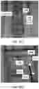 Fig. 49 - APPARATUS AND METHODS FOR USE WITH IMAGE-GUIDED SKELETAL PROCEDURES