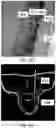 Fig. 50 - APPARATUS AND METHODS FOR USE WITH IMAGE-GUIDED SKELETAL PROCEDURES