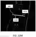 Fig. 54 - APPARATUS AND METHODS FOR USE WITH IMAGE-GUIDED SKELETAL PROCEDURES