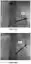 Fig. 55 - APPARATUS AND METHODS FOR USE WITH IMAGE-GUIDED SKELETAL PROCEDURES