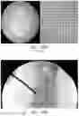 Fig. 60 - APPARATUS AND METHODS FOR USE WITH IMAGE-GUIDED SKELETAL PROCEDURES