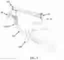 Fig. 07 - Surgical Instrument Holder