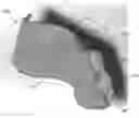 Fig. 01 - MULTIPLE MATERIAL DENTAL APPARATUSES AND TECHNIQUES FOR MAKING THE SAME