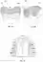 Fig. 02 - MULTIPLE MATERIAL DENTAL APPARATUSES AND TECHNIQUES FOR MAKING THE SAME