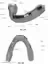Fig. 20 - MULTIPLE MATERIAL DENTAL APPARATUSES AND TECHNIQUES FOR MAKING THE SAME