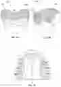 Fig. 02 - MODULAR FABRICATION OF DENTAL APPARATUSES