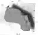 Fig. 03 - MODULAR FABRICATION OF DENTAL APPARATUSES