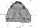 Fig. 04 - MODULAR FABRICATION OF DENTAL APPARATUSES