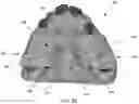 Fig. 05 - MODULAR FABRICATION OF DENTAL APPARATUSES