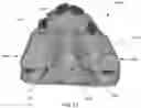 Fig. 13 - MODULAR FABRICATION OF DENTAL APPARATUSES