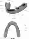 Fig. 20 - MODULAR FABRICATION OF DENTAL APPARATUSES