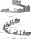 Fig. 22 - MODULAR FABRICATION OF DENTAL APPARATUSES