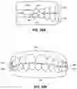 Fig. 25 - MODULAR FABRICATION OF DENTAL APPARATUSES