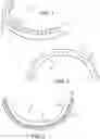 Fig. 02 - LIP ENHANCEMENT DEVICE