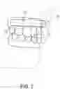 Fig. 04 - LIP ENHANCEMENT DEVICE