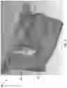 Fig. 03 - Combining data from multiple dental anatomy scans