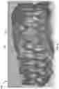 Fig. 05 - Combining data from multiple dental anatomy scans