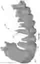 Fig. 10 - Combining data from multiple dental anatomy scans