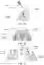 Fig. 06 - Method for sub-gingival intraoral scanning