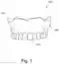 Fig. 02 - Split denture