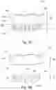 Fig. 03 - Split denture
