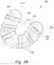 Fig. 04 - Split denture