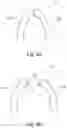 Fig. 06 - Split denture