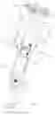 Fig. 03 - ORAL IRRIGATOR