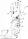 Fig. 01 - RIGID SALIVA EJECTOR