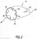 Fig. 03 - RIGID SALIVA EJECTOR