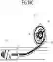 Fig. 62 - SYSTEMS, METHODS AND DEVICES FOR EMBOLIC PROTECTION