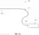 Fig. 02 - SYSTEMS, DEVICES, AND METHODS FOR THE RETRIEVAL OF AN IMPLANT IN THE PROSTATIC URETHRA