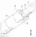 Fig. 07 - SYSTEMS, DEVICES, AND METHODS FOR THE RETRIEVAL OF AN IMPLANT IN THE PROSTATIC URETHRA