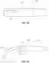 Fig. 12 - SYSTEMS, DEVICES, AND METHODS FOR THE RETRIEVAL OF AN IMPLANT IN THE PROSTATIC URETHRA