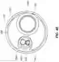 Fig. 17 - SYSTEMS, DEVICES, AND METHODS FOR THE RETRIEVAL OF AN IMPLANT IN THE PROSTATIC URETHRA