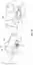 Fig. 19 - SYSTEMS, DEVICES, AND METHODS FOR THE RETRIEVAL OF AN IMPLANT IN THE PROSTATIC URETHRA